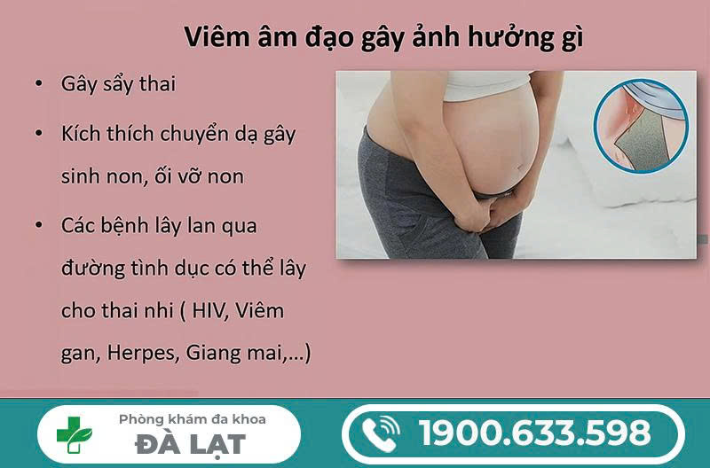 Hình ảnh minh họa